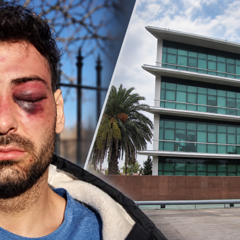 Investigan a policías de la Seccional Primera por la golpiza denunciada por un joven en Santa Rosa
